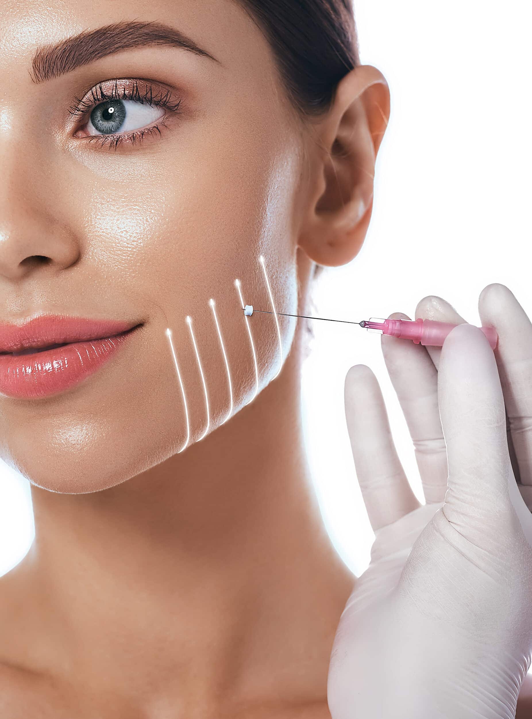 Microneedling in Fort Worth, TX