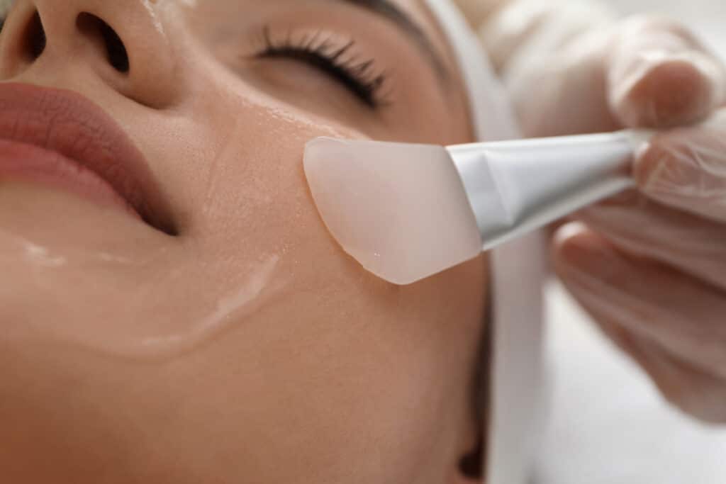 Woman getting a medical-grade peel in Fort Worth, TX